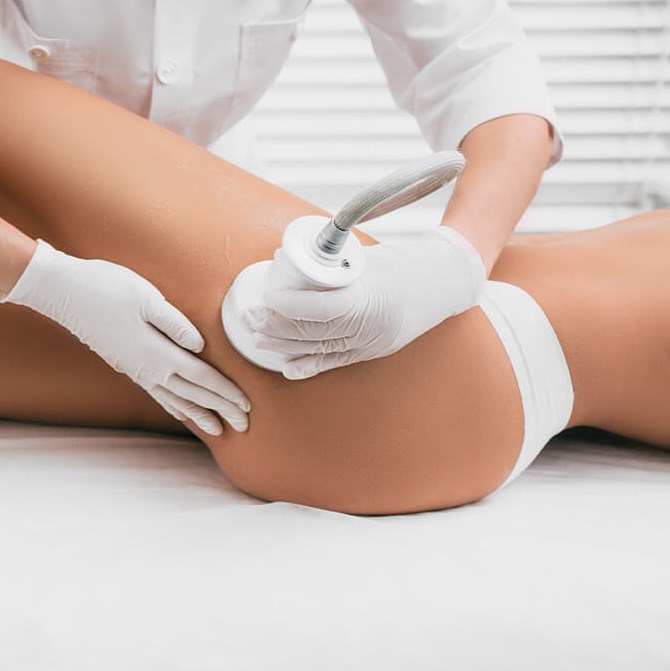 cellulite reduction
